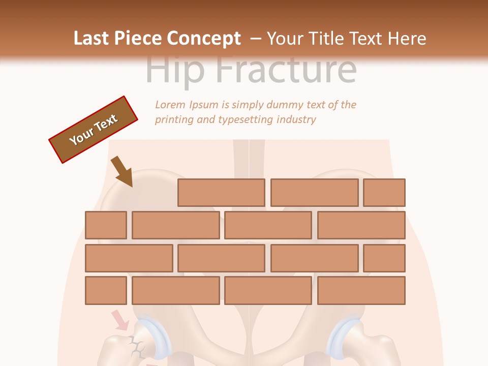 Injured Hip Illustration PowerPoint Template
