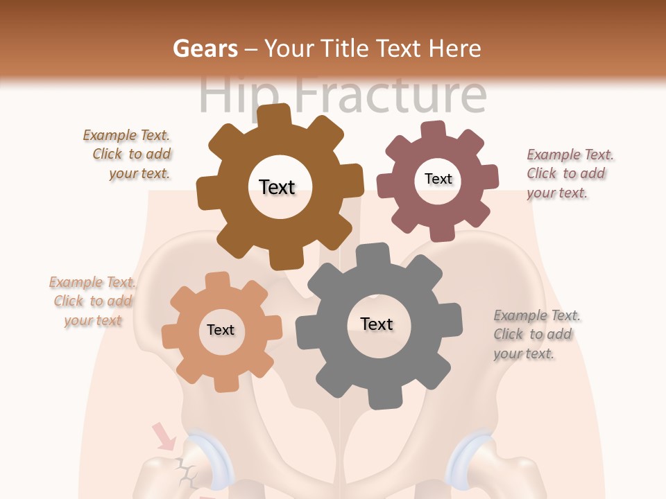 Injured Hip Illustration PowerPoint Template