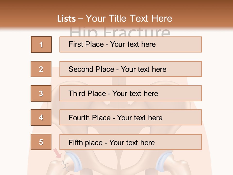 Injured Hip Illustration PowerPoint Template