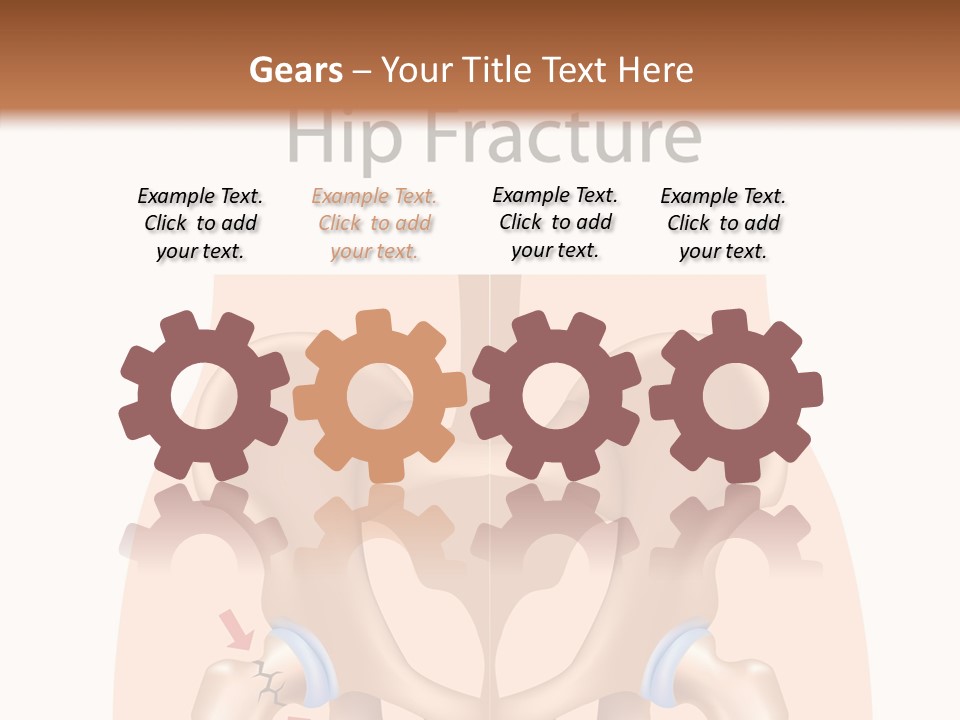 Injured Hip Illustration PowerPoint Template