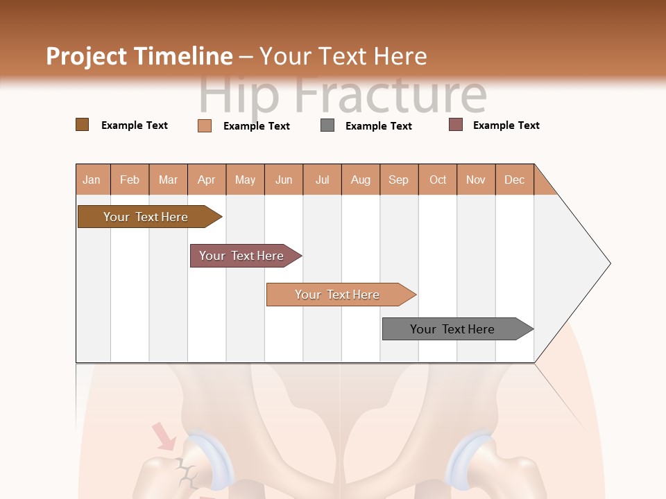Injured Hip Illustration PowerPoint Template