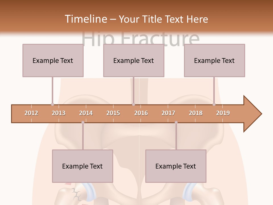 Injured Hip Illustration PowerPoint Template