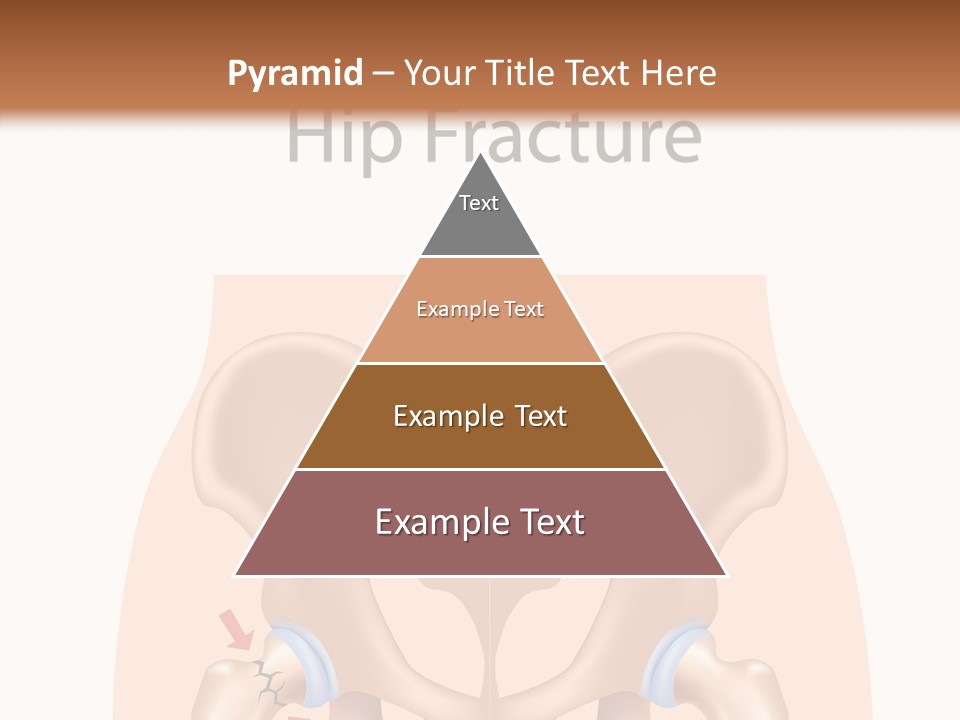 Injured Hip Illustration PowerPoint Template