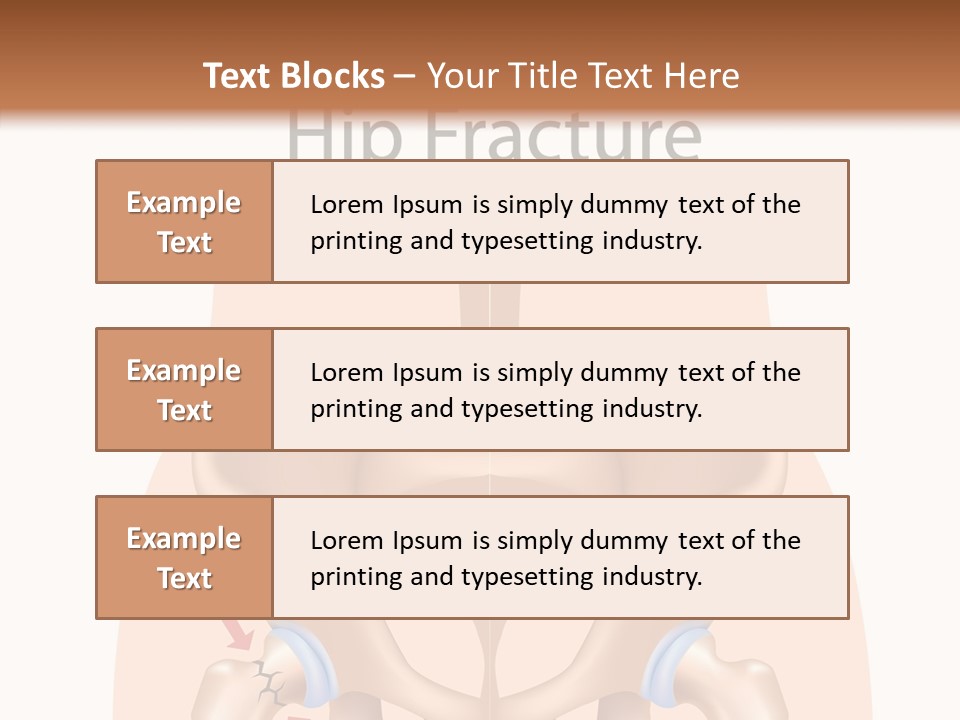 Injured Hip Illustration PowerPoint Template