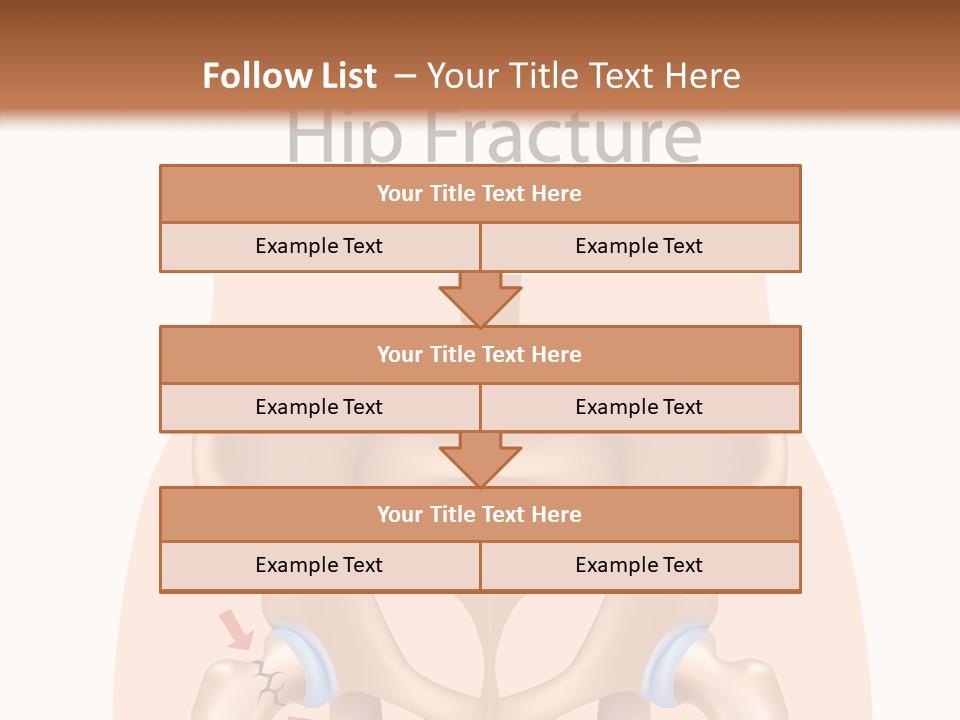 Injured Hip Illustration PowerPoint Template