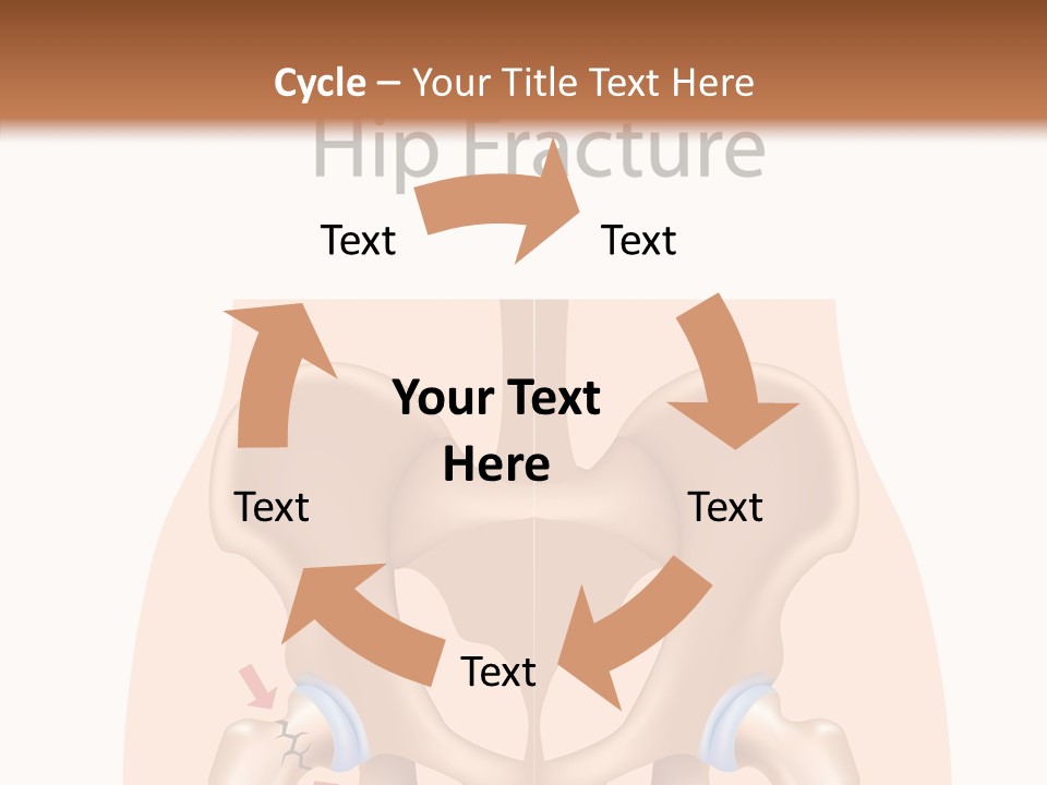 Injured Hip Illustration PowerPoint Template