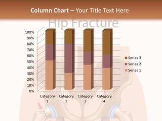 Injured Hip Illustration PowerPoint Template