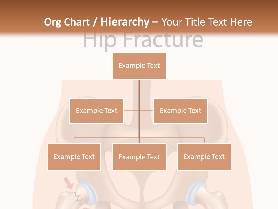 Injured Hip Illustration PowerPoint Template