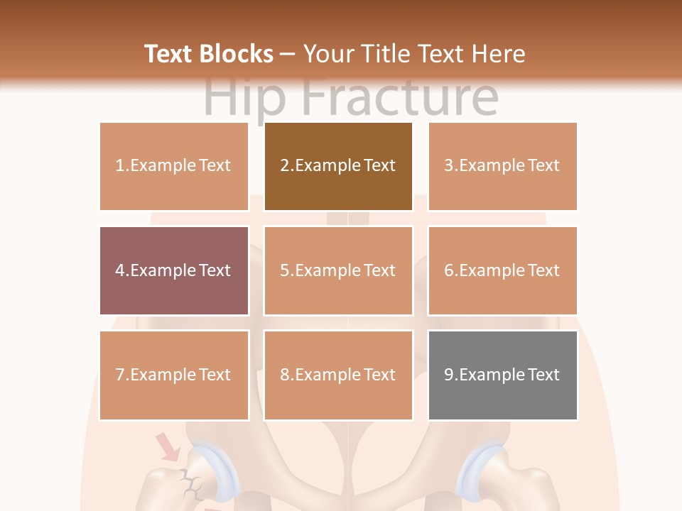 Injured Hip Illustration PowerPoint Template