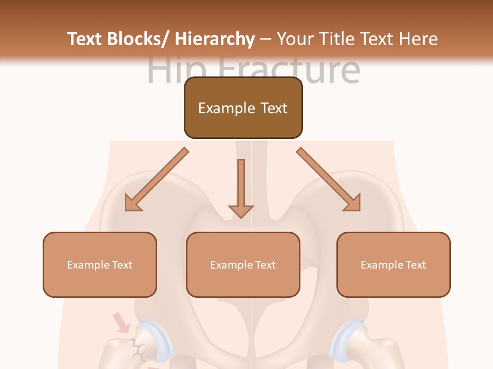 Injured Hip Illustration PowerPoint Template