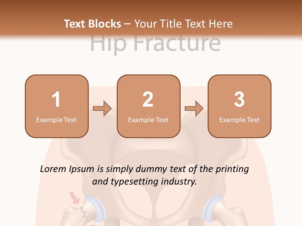 Injured Hip Illustration PowerPoint Template