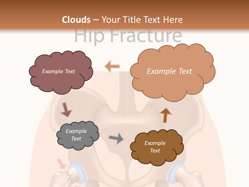 Injured Hip Illustration PowerPoint Template