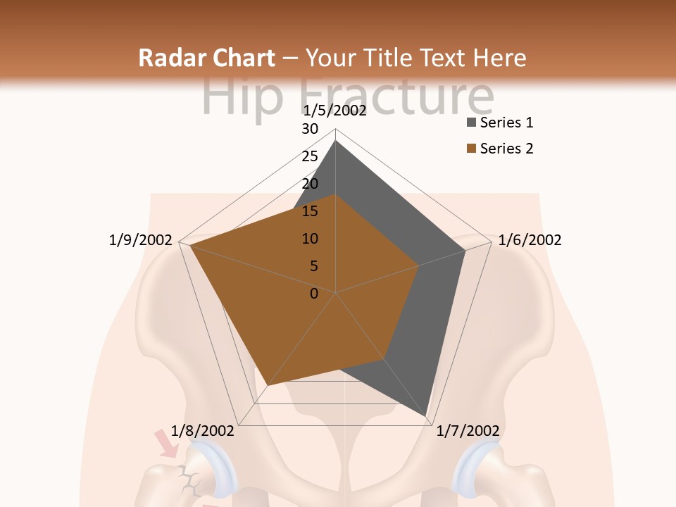 Injured Hip Illustration PowerPoint Template