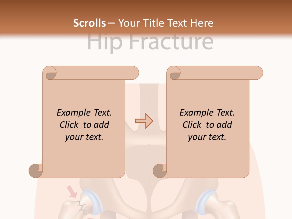 Injured Hip Illustration PowerPoint Template