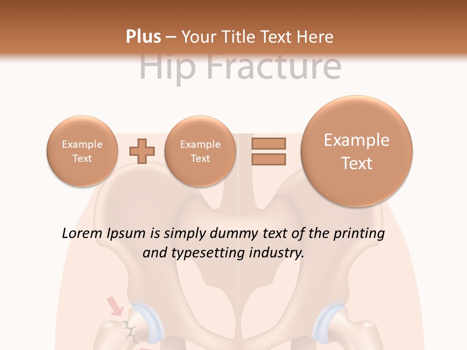 Injured Hip Illustration PowerPoint Template