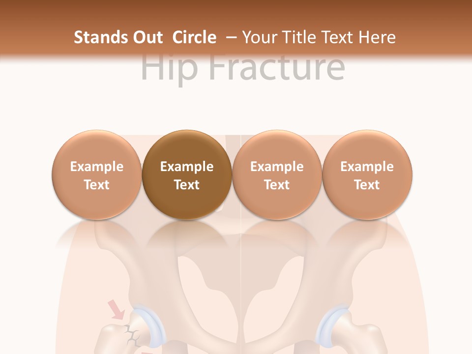 Injured Hip Illustration PowerPoint Template