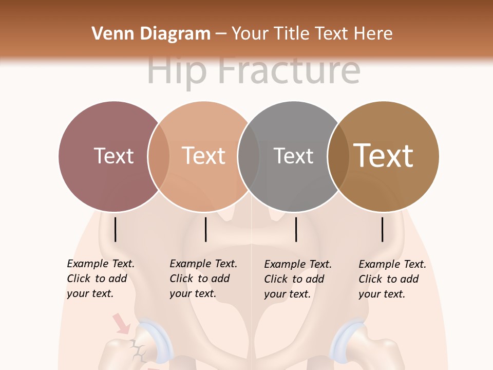 Injured Hip Illustration PowerPoint Template