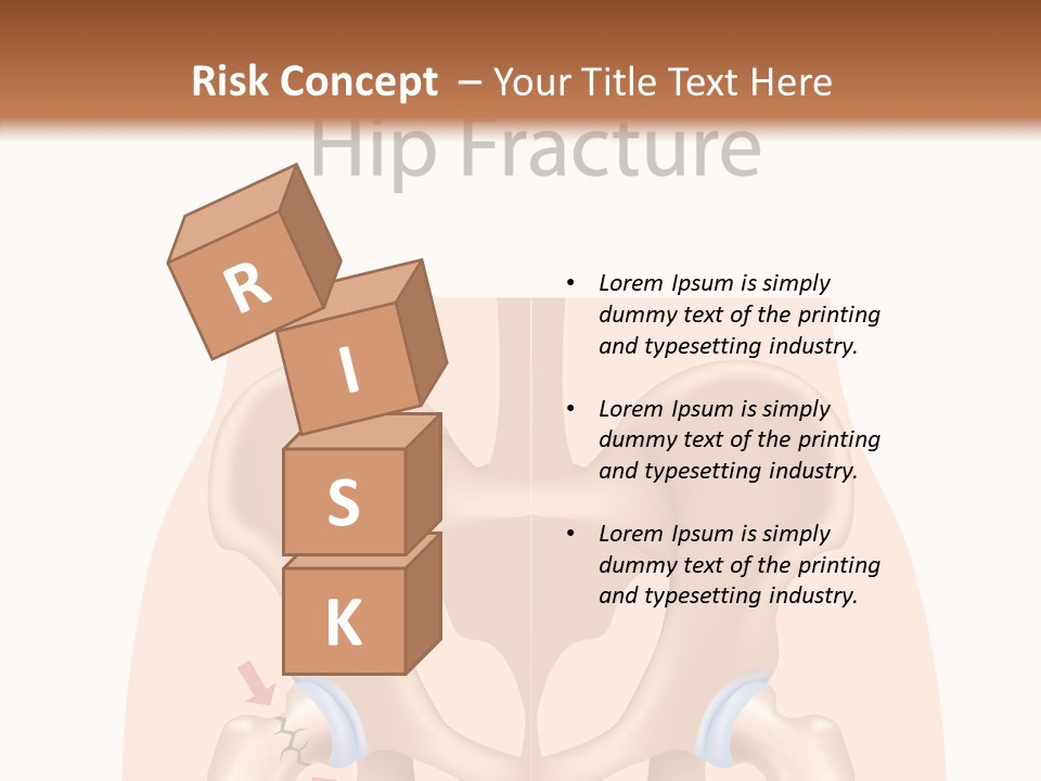 Injured Hip Illustration PowerPoint Template