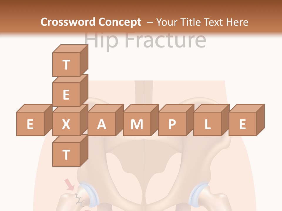 Injured Hip Illustration PowerPoint Template