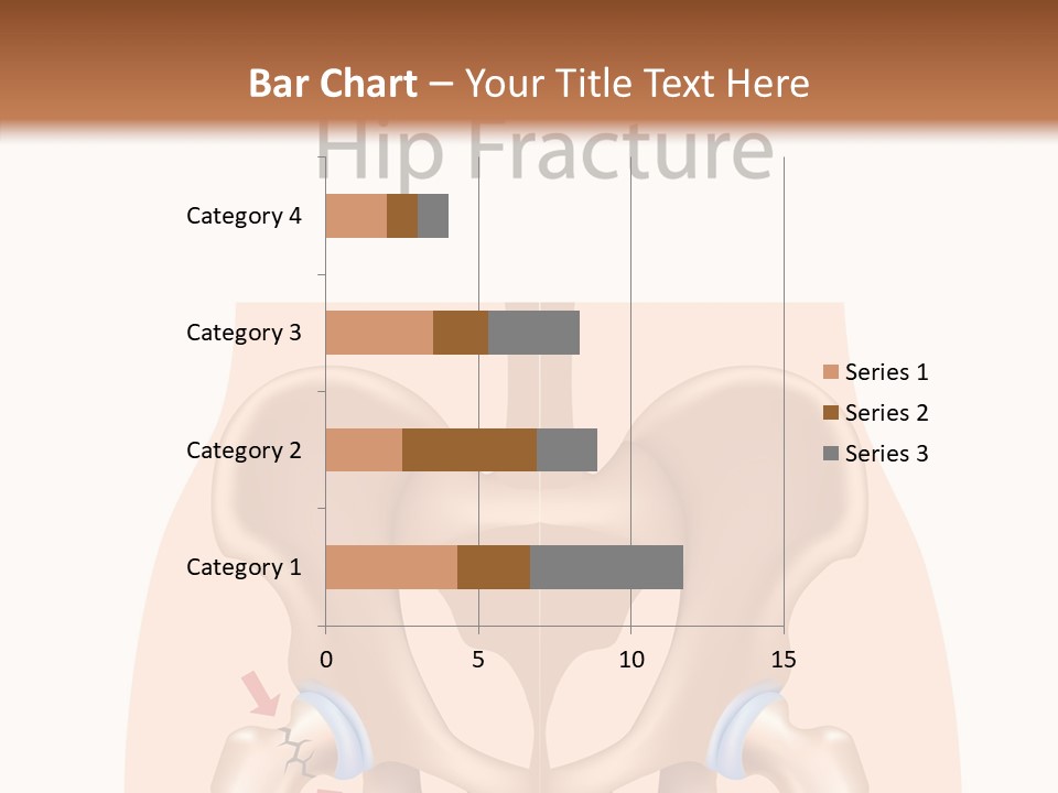 Injured Hip Illustration PowerPoint Template