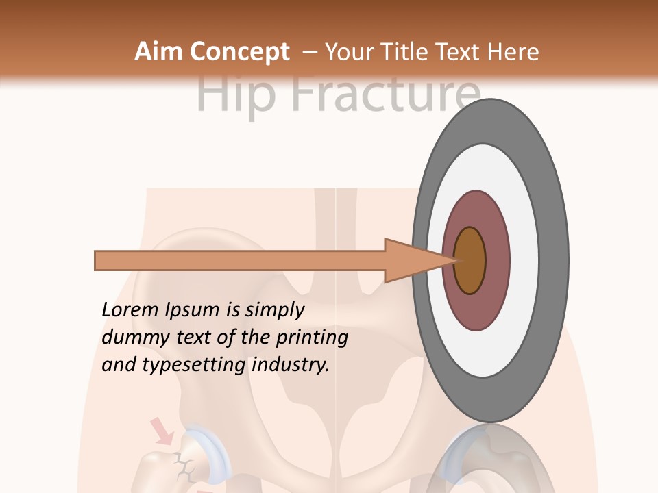 Injured Hip Illustration PowerPoint Template