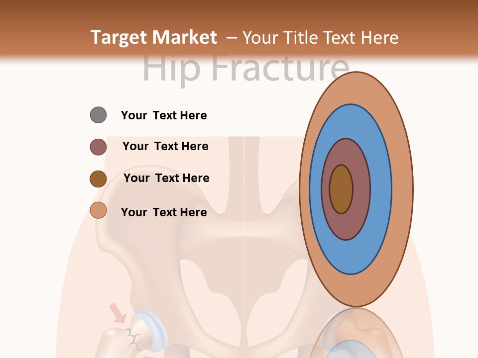 Injured Hip Illustration PowerPoint Template
