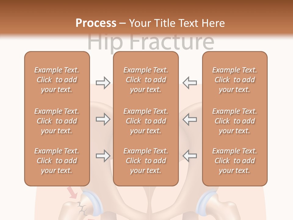 Injured Hip Illustration PowerPoint Template