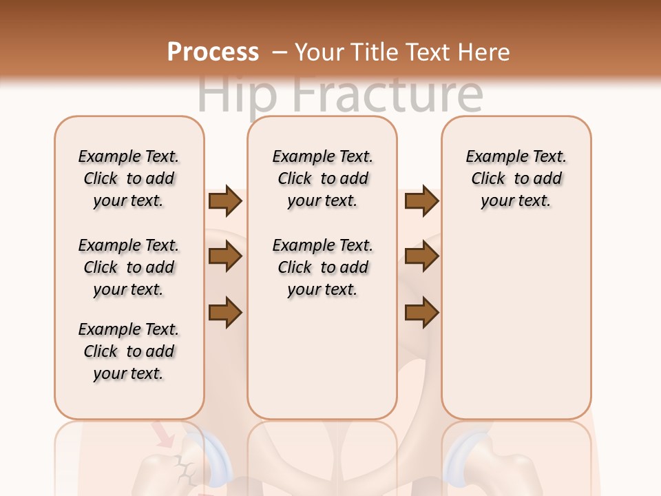 Injured Hip Illustration PowerPoint Template