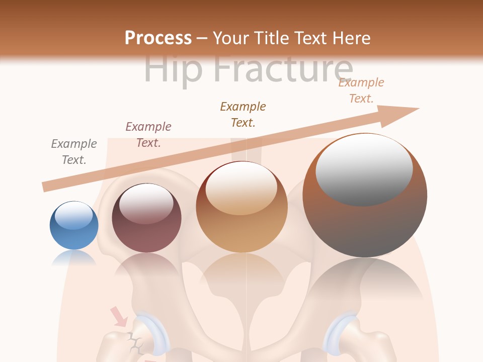 Injured Hip Illustration PowerPoint Template