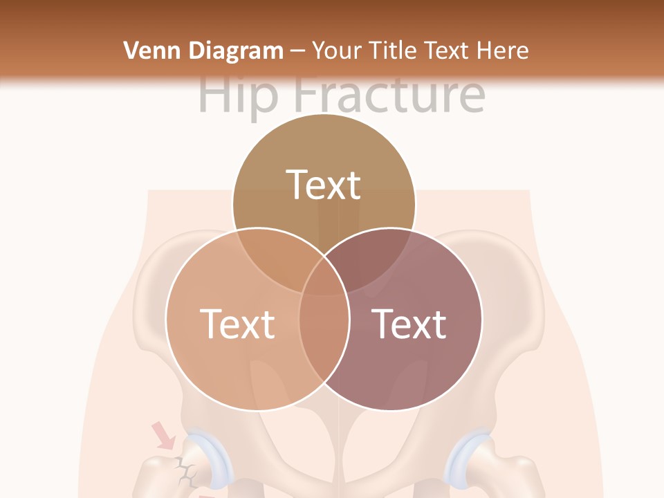 Injured Hip Illustration PowerPoint Template