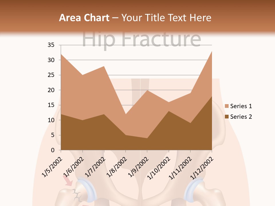 Injured Hip Illustration PowerPoint Template