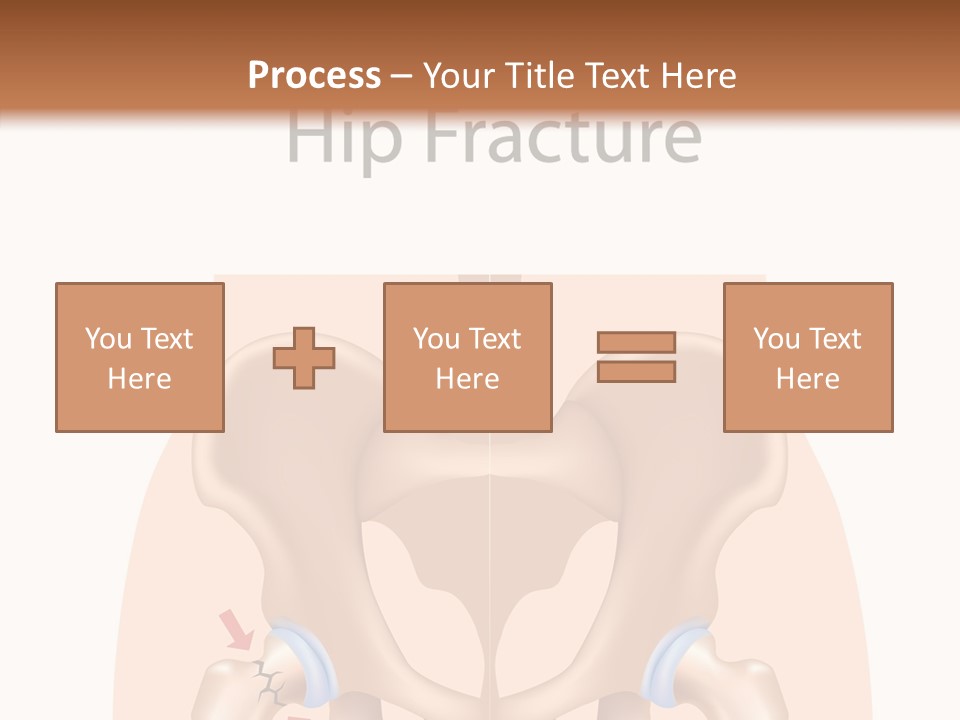 Injured Hip Illustration PowerPoint Template