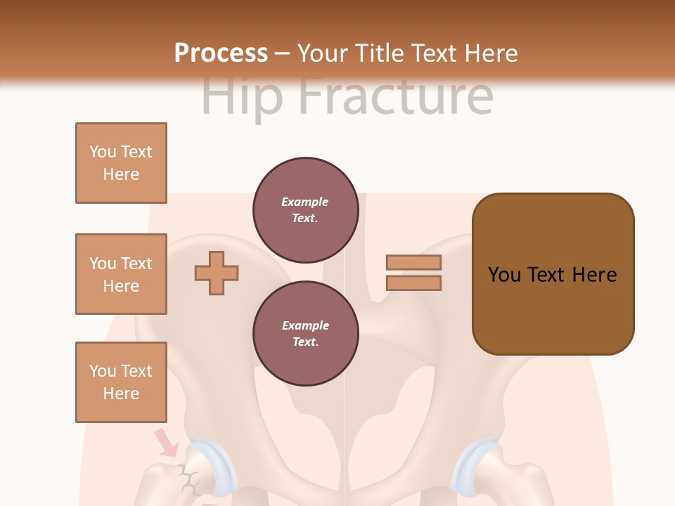 Injured Hip Illustration PowerPoint Template
