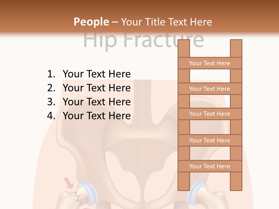 Injured Hip Illustration PowerPoint Template