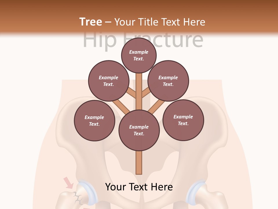 Injured Hip Illustration PowerPoint Template