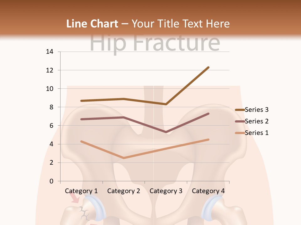 Injured Hip Illustration PowerPoint Template