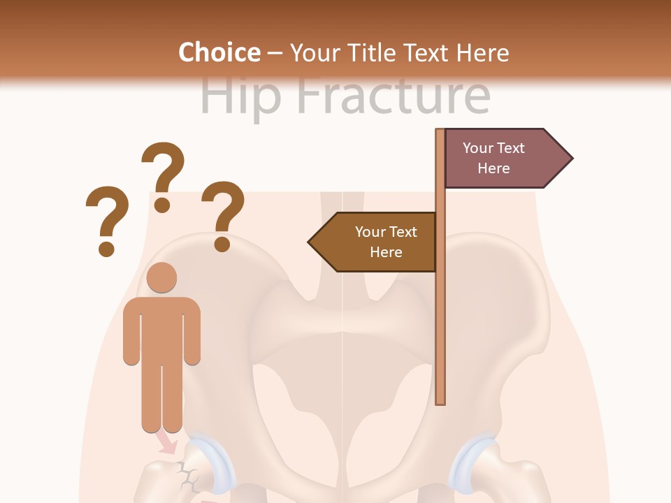 Injured Hip Illustration PowerPoint Template