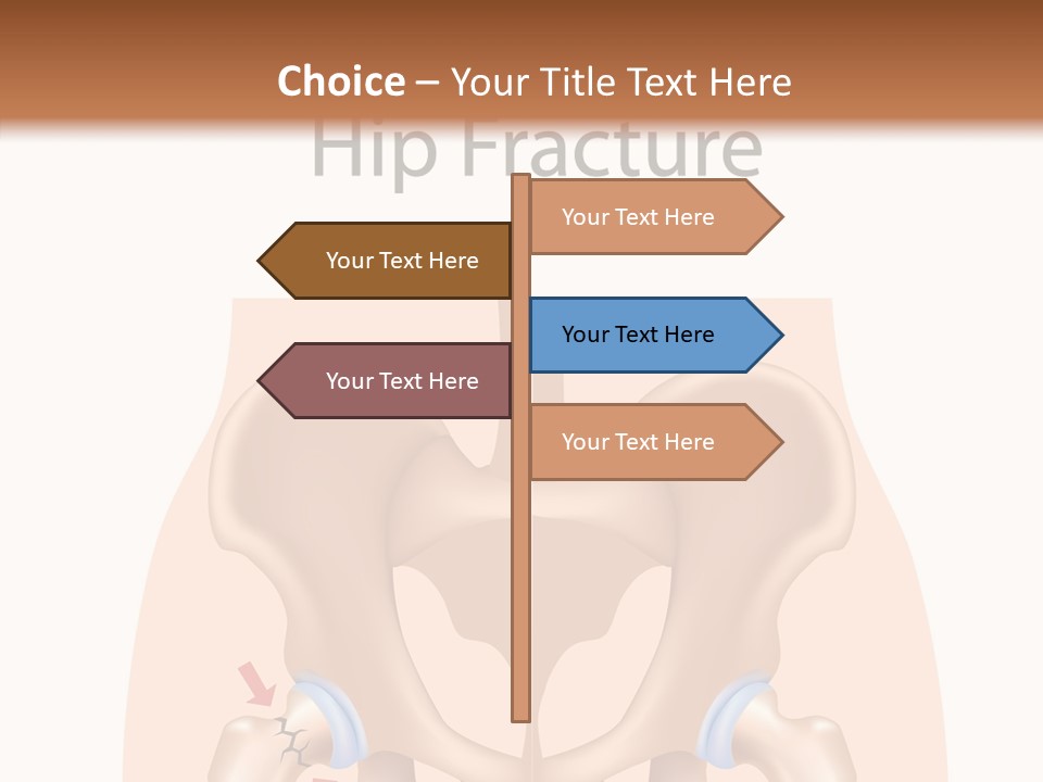 Injured Hip Illustration PowerPoint Template