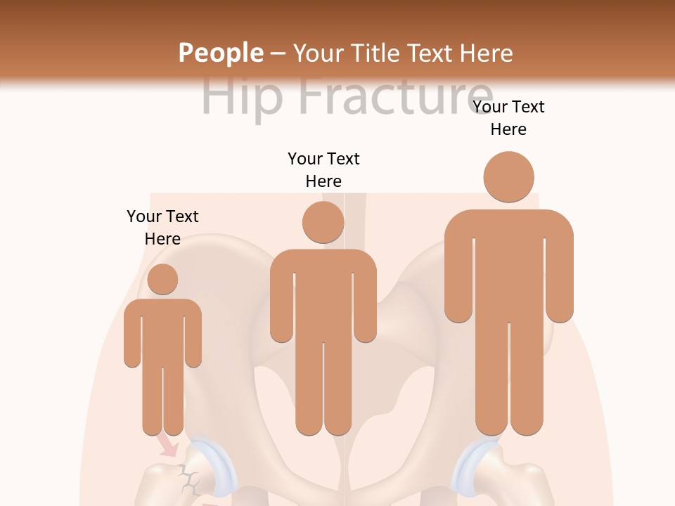 Injured Hip Illustration PowerPoint Template