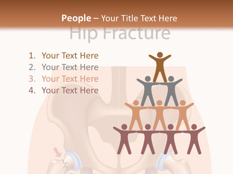 Injured Hip Illustration PowerPoint Template