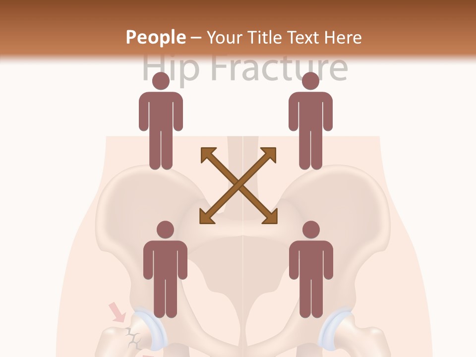 Injured Hip Illustration PowerPoint Template
