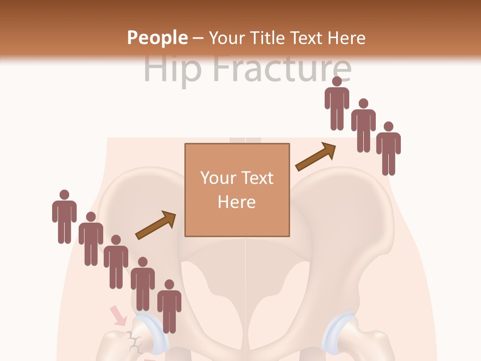 Injured Hip Illustration PowerPoint Template
