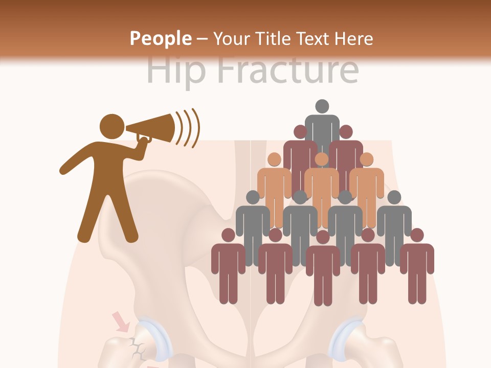 Injured Hip Illustration PowerPoint Template