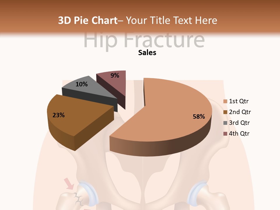 Injured Hip Illustration PowerPoint Template