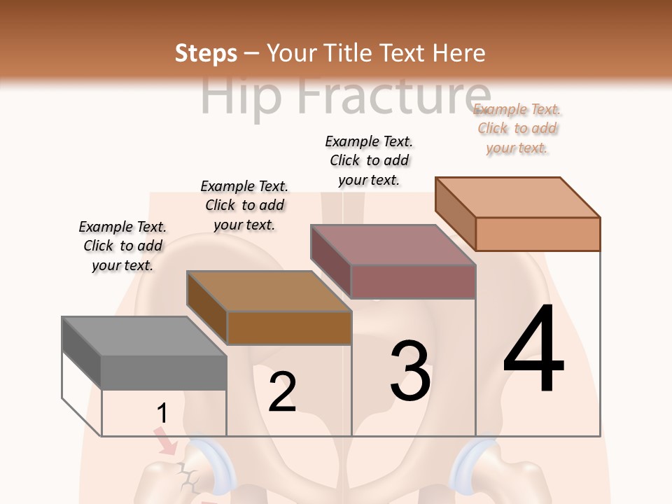 Injured Hip Illustration PowerPoint Template