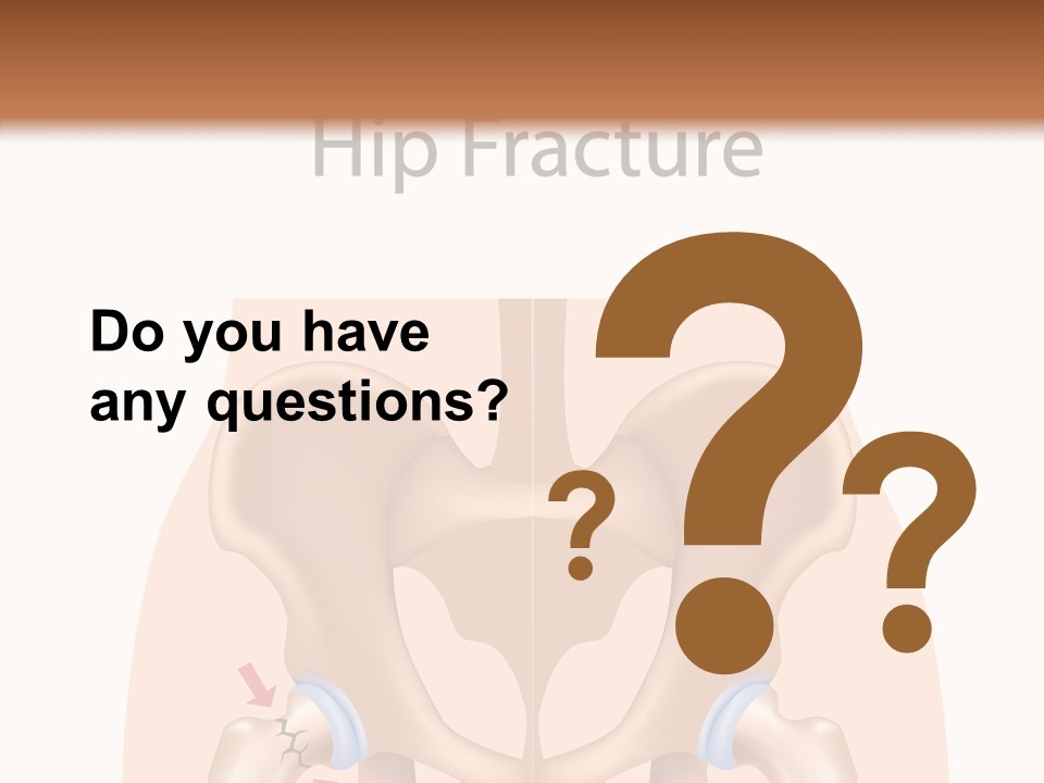 Injured Hip Illustration PowerPoint Template