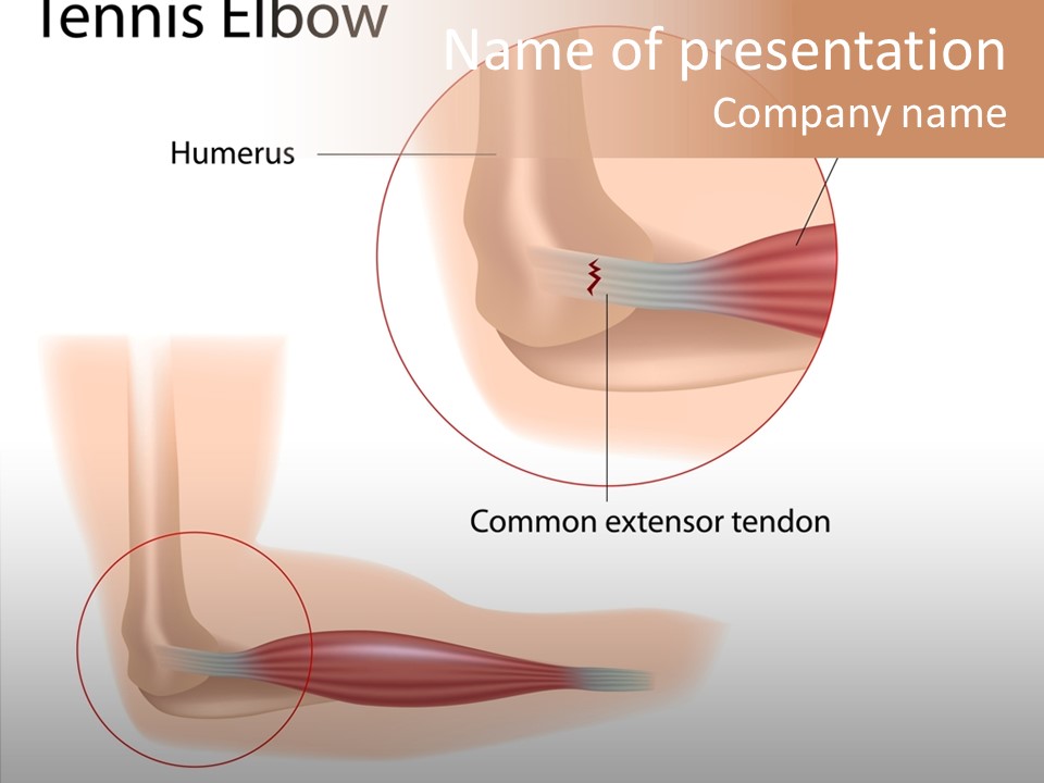 Human Surgery Illustration PowerPoint Template