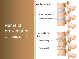 Medicine Posture Disk PowerPoint Template