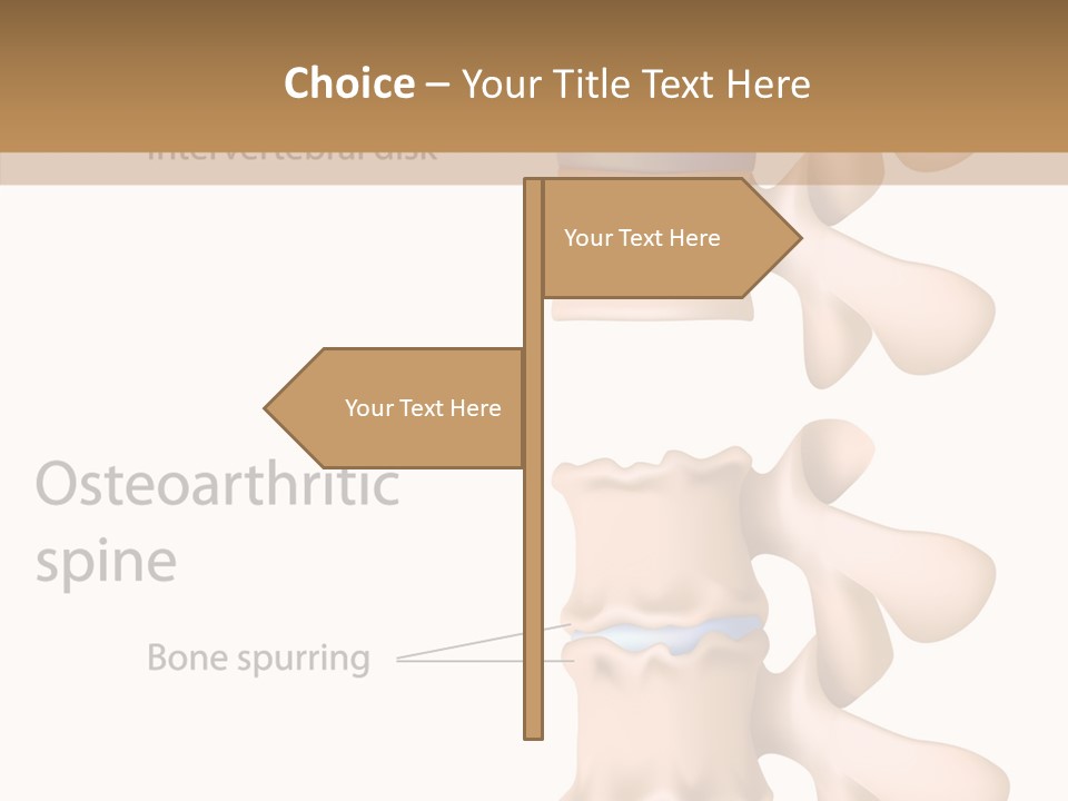 Medicine Posture Disk PowerPoint Template