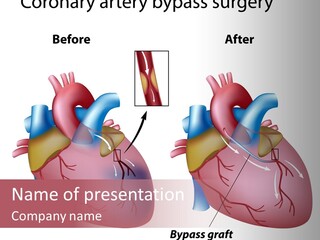 Clogged Heartbeat Illustration PowerPoint Template